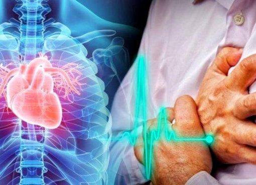 Serangan Jantung: Kenali Gejala dan Cara Ampuh Mencegahnya Sejak Dini Serangan Jantung