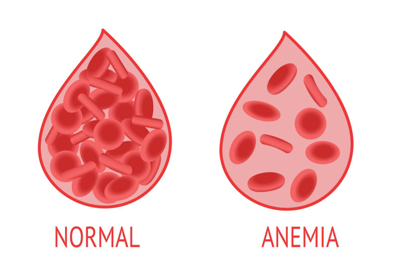 Gejala Anemia