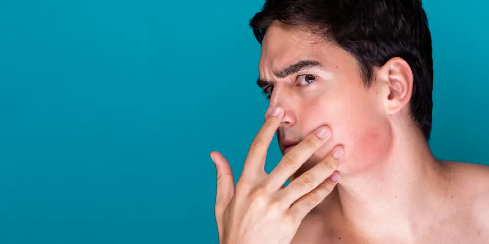 Burkitt Lymphoma: Kanker Langka yang Bergerak Cepat, Namun Bisa Disembuhkan